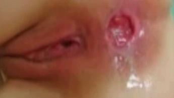 Aufgebohrte Rosette mit Anal-Creampie!